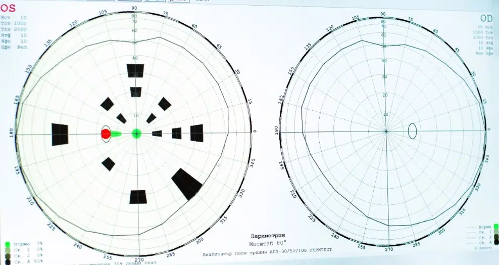результаты периметрии